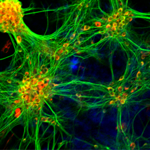 Futuristic looking micropscopy image captured from neurons stained with different antibodies - AiF and MAP2