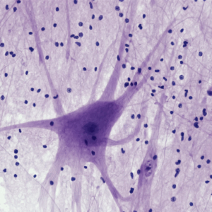 GSC cells