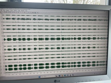 First in vivo recordings are in